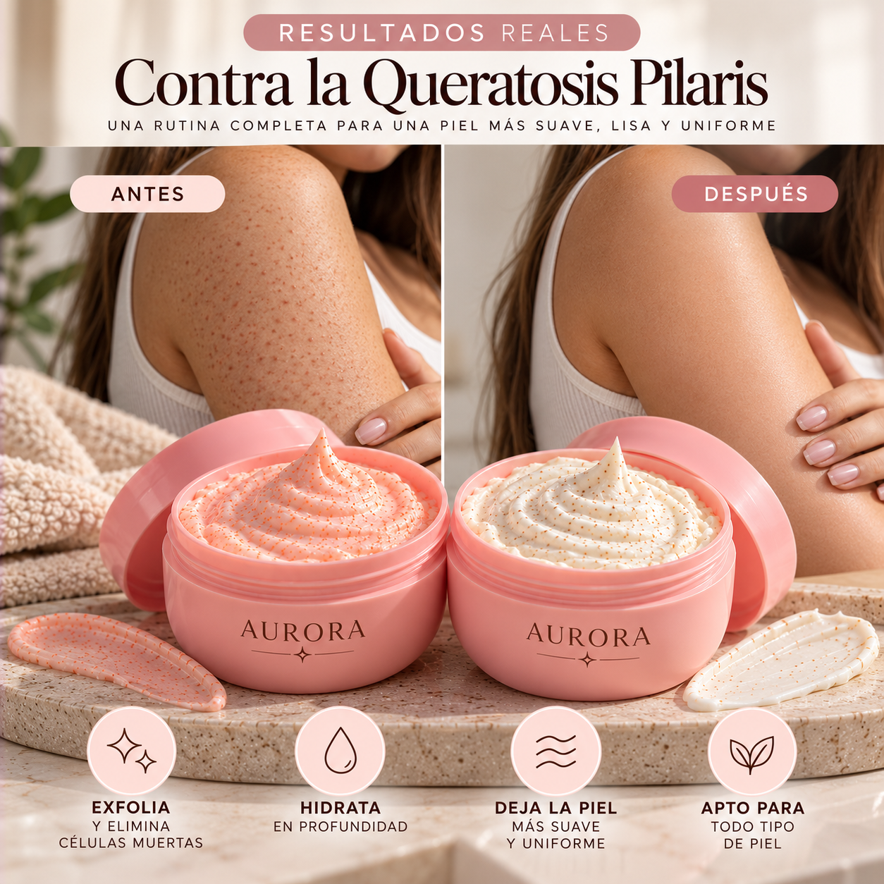 Antes y despu&eacute;s con Aurora contra la queratosis pilaris